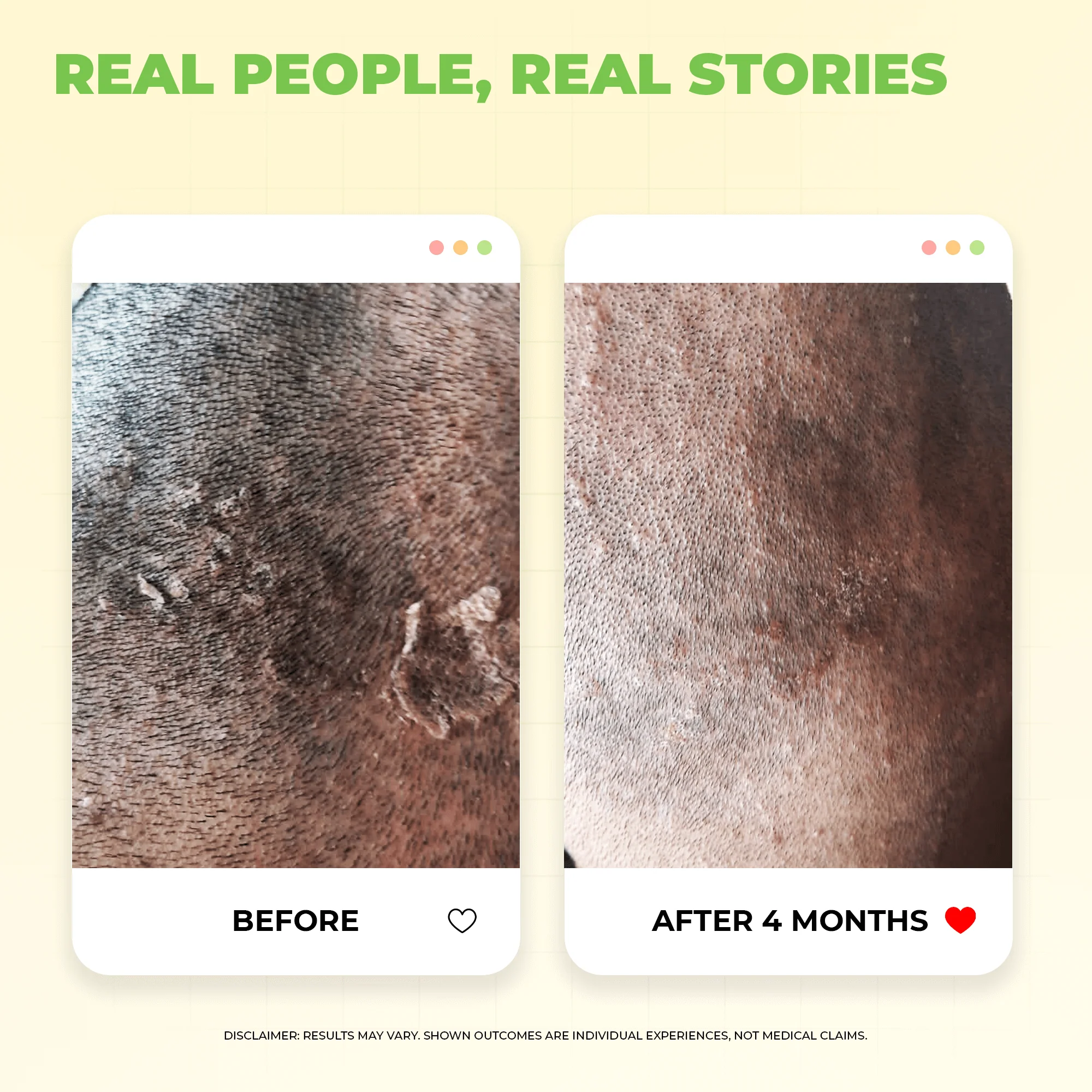 Scalptone Dandruff Serum - Image 7