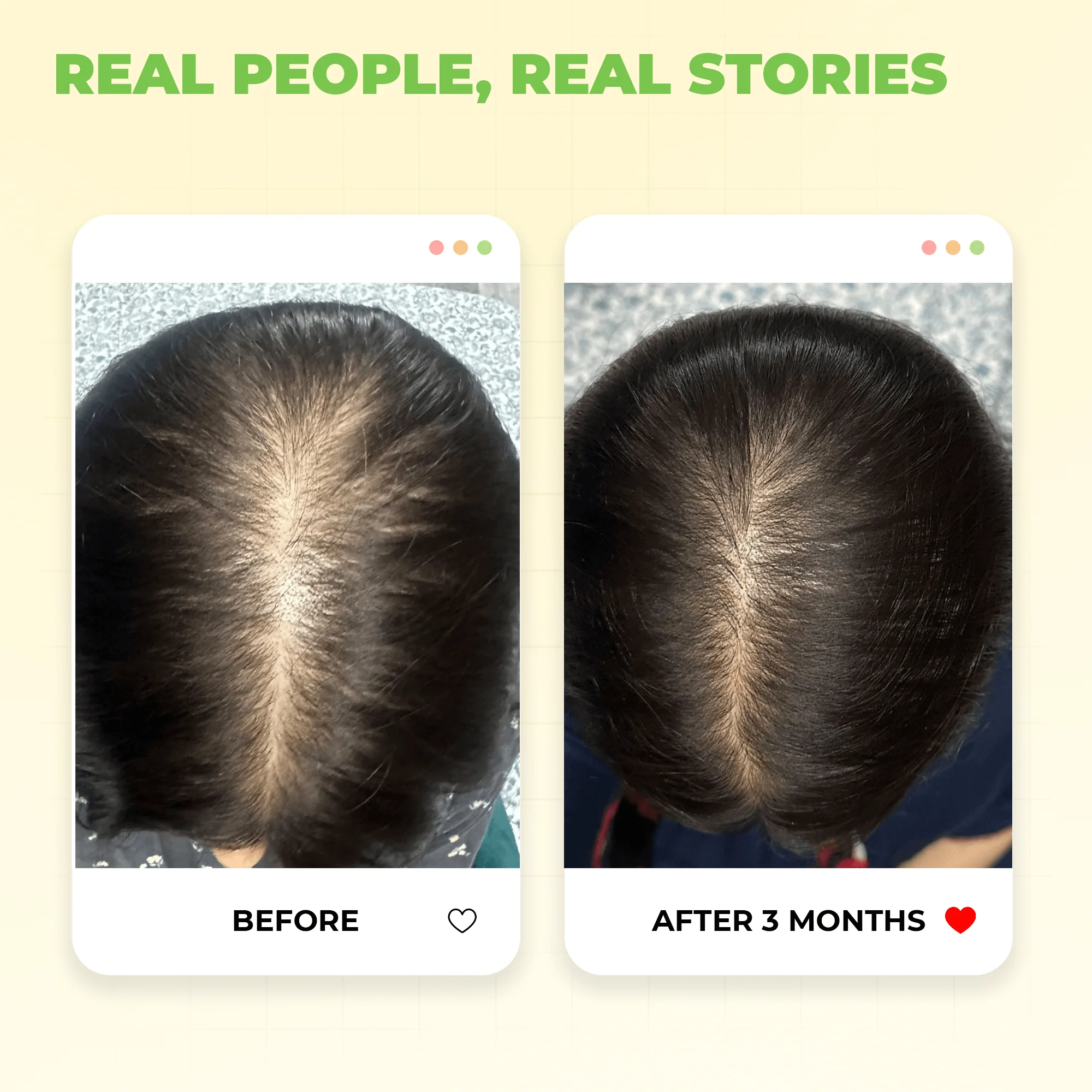 Cold Pressed Castor Oil for Hair Growth - Image 4