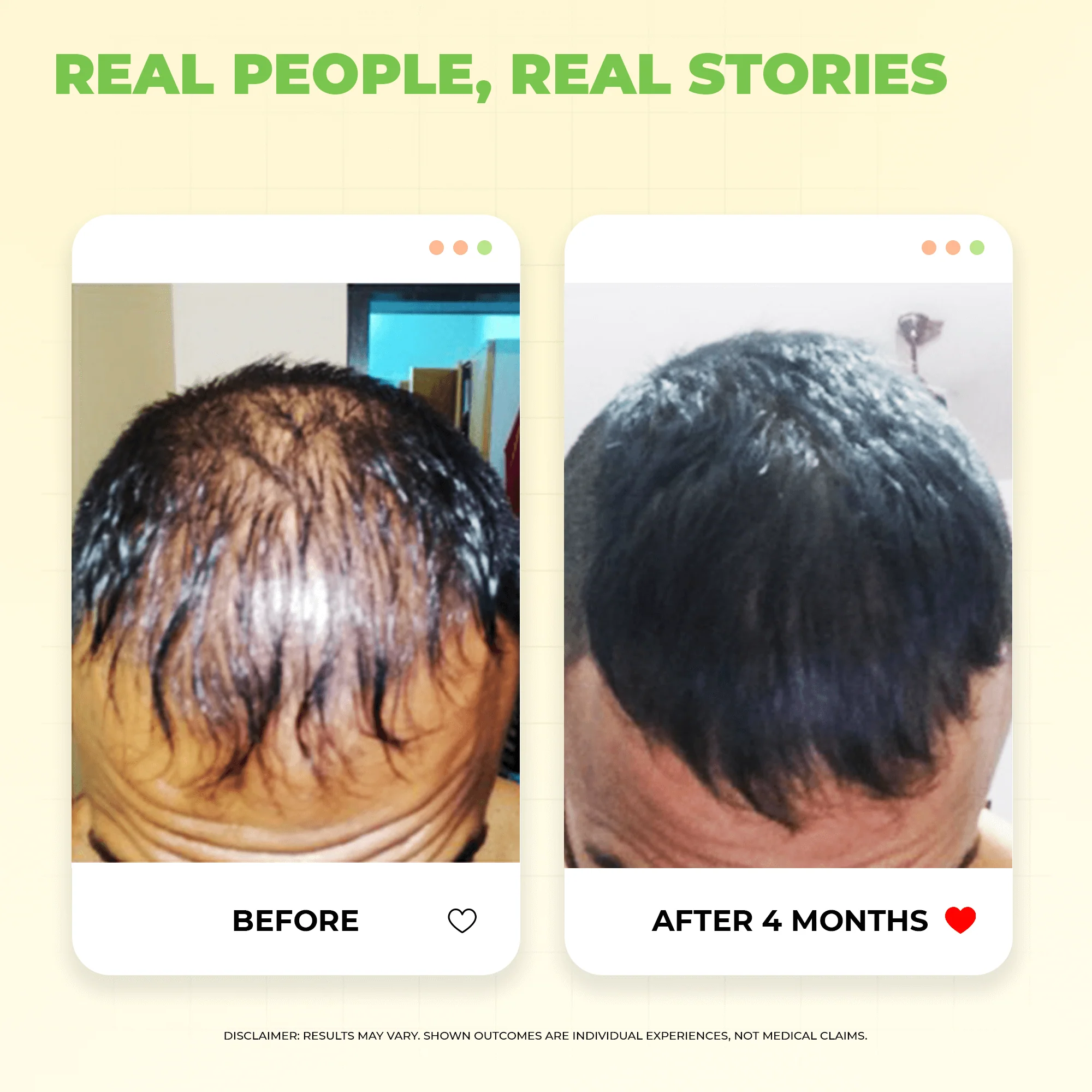 Hair Tonic PV 1 Scalp Spray A Natural DHT Blocker - Image 5