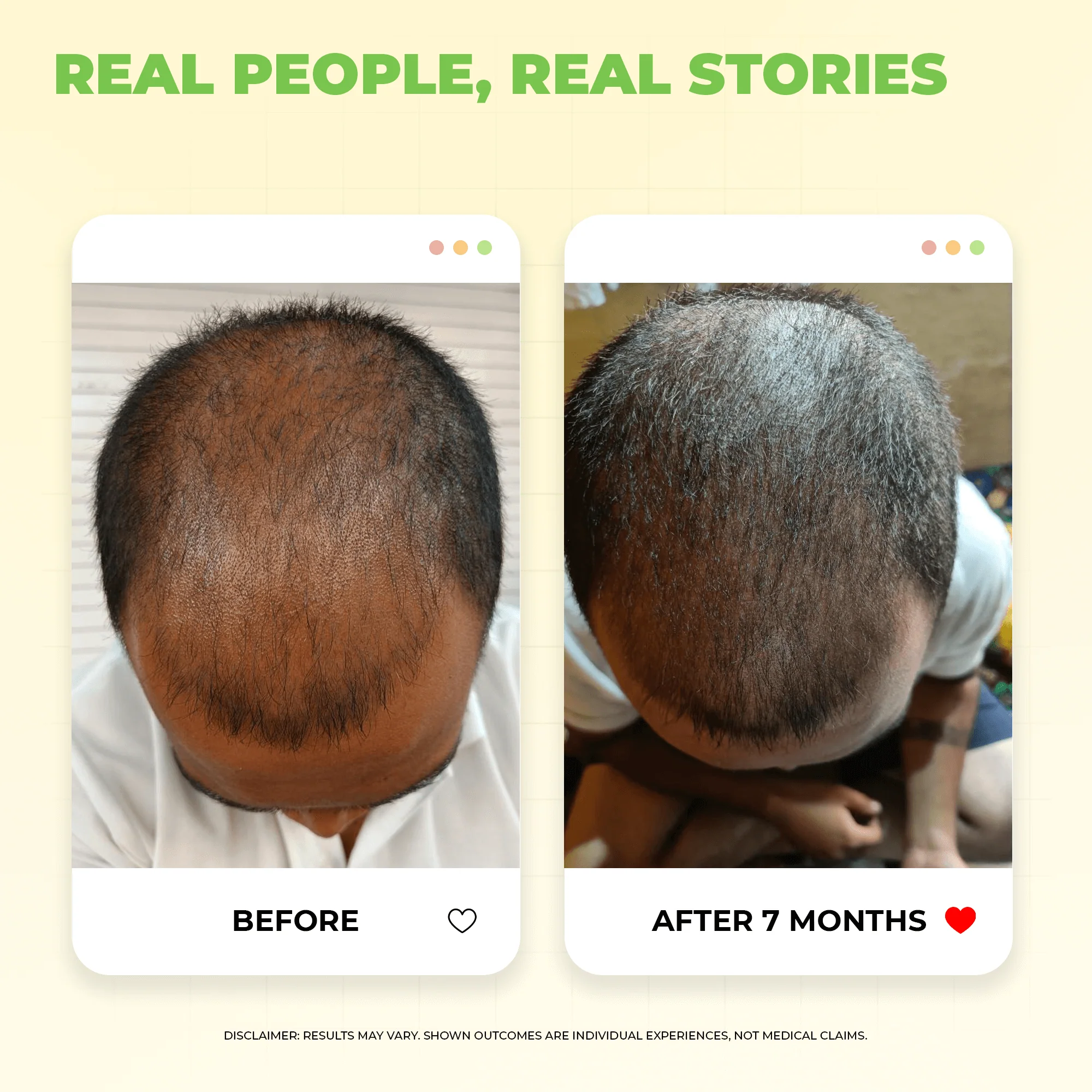 Keshpallav Hair Oil for Hair Growth with 5% Nansyl & Rosemary Extracts - Image 5