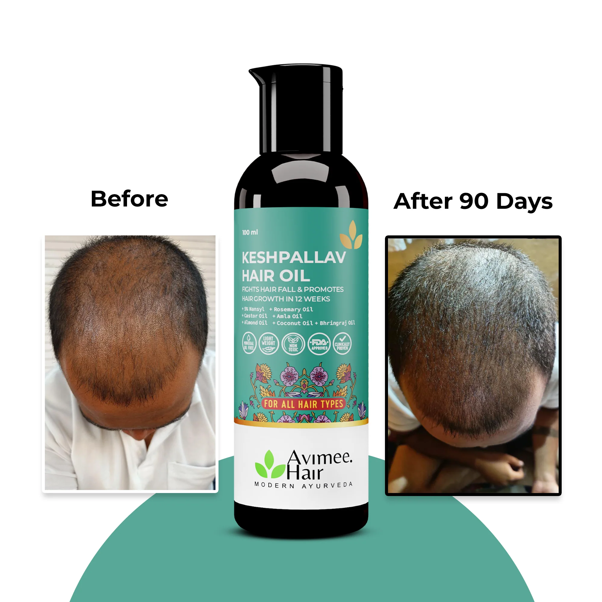 Keshpallav Hair Oil + Shakuntala Daily Use Shampoo Super Saver Combo - Image 5